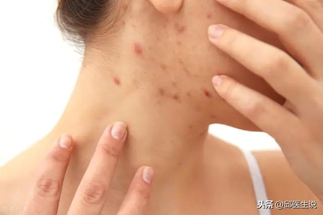 Understanding Different Types of Dampness in Traditional Chinese Medicine: Cold Damp, Damp Heat, Phlegm Damp, and More