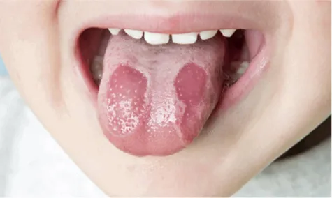 The Consequences of Yin Deficiency: 4 Methods to Restore Lost Body Fluids for a Hydrated Body