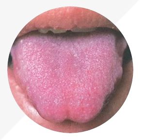 Analysis of High-Definition Tongue Diagnosis Charts: Understanding Health Through Your Tongue (Part 1)