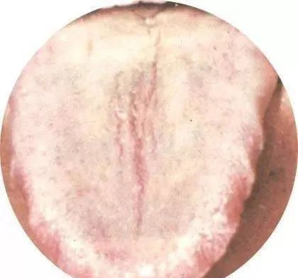 130 High-Definition Tongue Diagnosis Charts (Recommended for Collection)