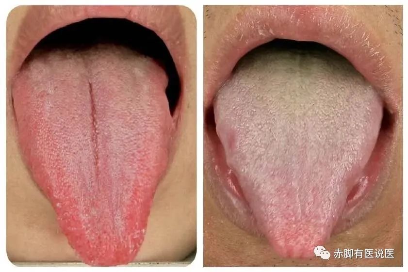 Understanding Your Tongue Diagnosis in 10 Minutes