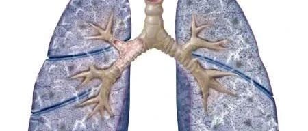 Exploring the Role of Collaterals in Systemic Sclerosis with Interstitial Lung Disease Based on the Concept of 'Lung as a Blood Organ'
