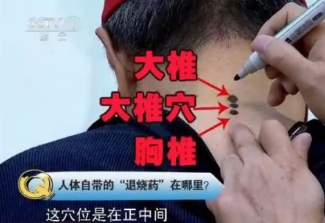 Is Bloodletting, Gua Sha, and Foot Soaking Effective After a Fever? The Truth Is...