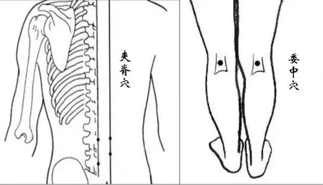 Conditions That Can Be Alleviated by Gua Sha