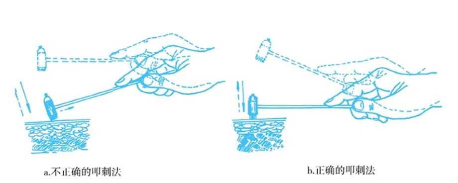 Bloodletting Therapy in Traditional Chinese Medicine (Part 1)