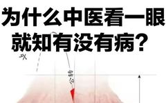 Traditional Chinese Medicine Tongue Diagnosis (Recommended for Collection)