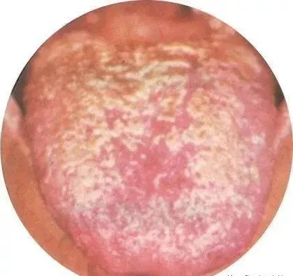 130 High-Definition Tongue Diagnosis Charts (Recommended for Collection)