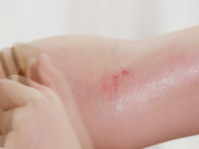 Spring Liver Nourishment: Gua Sha Techniques for Liver Health