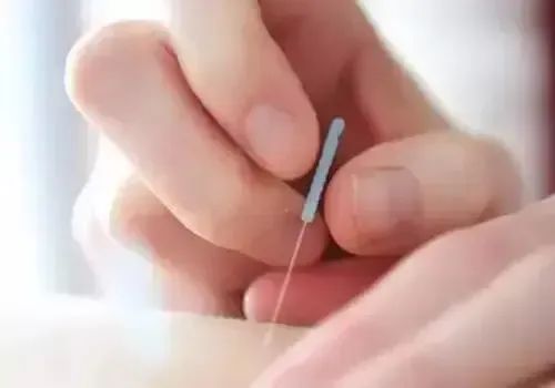 Bloodletting Therapy for 24 Difficult Diseases