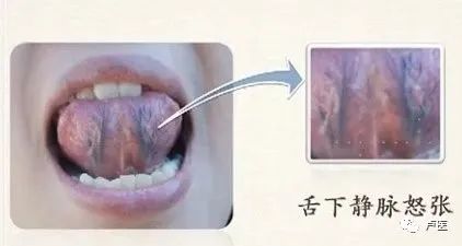 Exploring Tongue Diagnosis in Traditional Chinese Medicine: Hidden Insights and Tongue Diagnosis Atlas