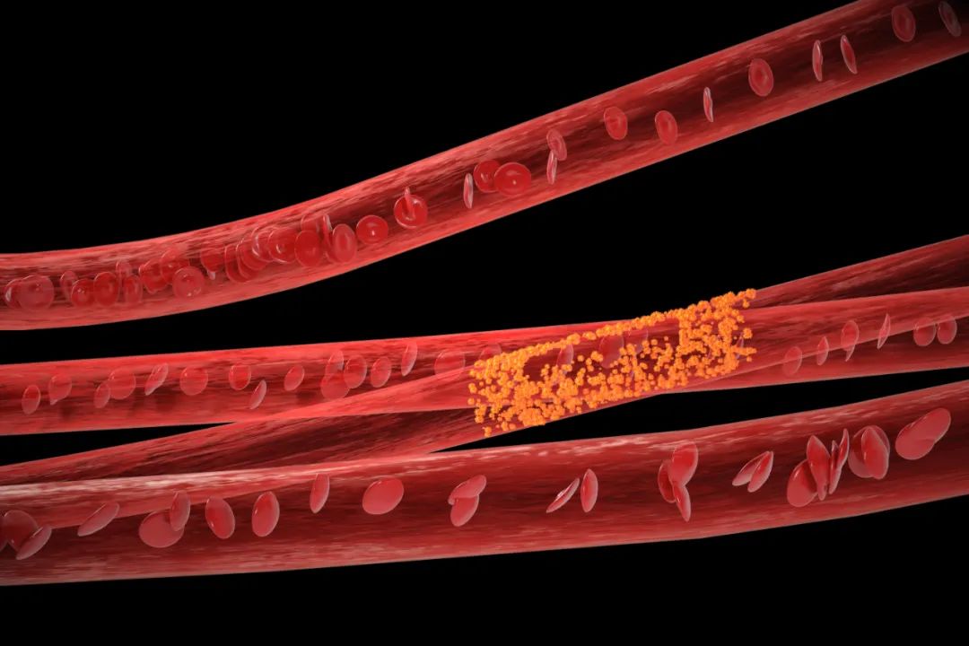 9 Points to Self-Check for Qi Stagnation and Blood Stasis: Are You Affected?