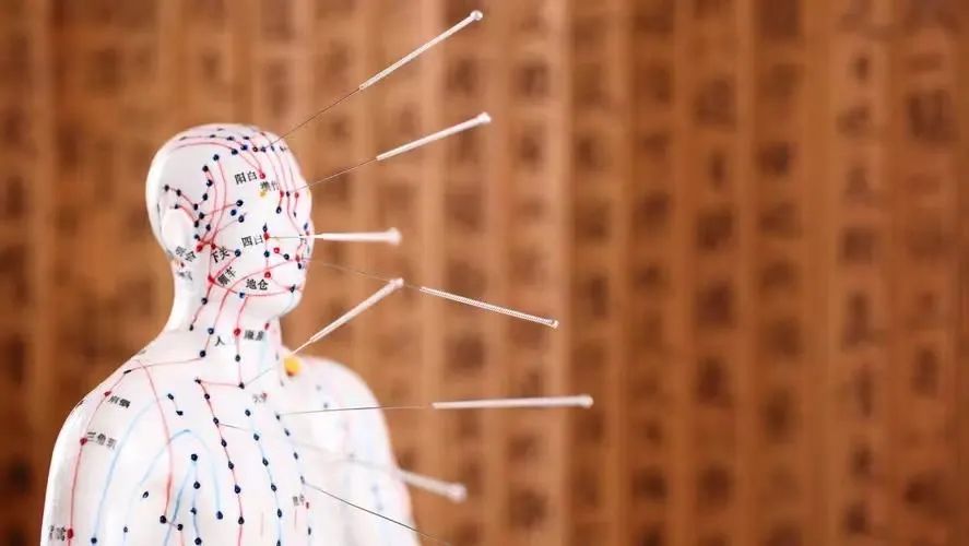 Inheriting Acupuncture Techniques and Promoting Traditional Chinese Medicine Culture