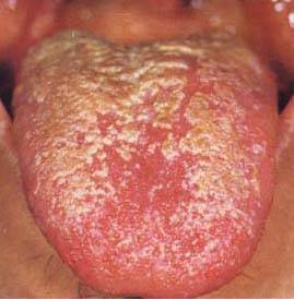 62 High-Definition Tongue Diagnosis Charts with Illustrations (Collector's Edition)