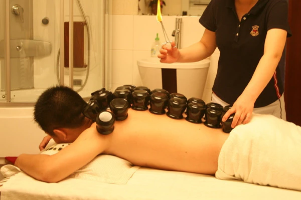 The Techniques and Diagnosis of Cupping and Sliding Cupping in Traditional Chinese Medicine