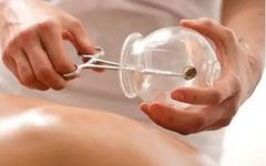 Cupping Therapy Techniques in Traditional Chinese Medicine