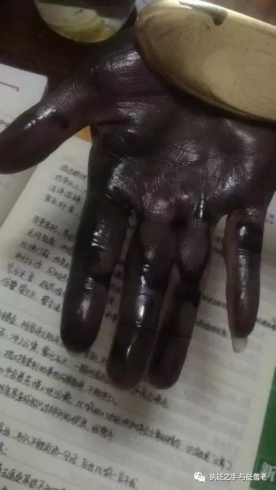 Black Sha: The Surprising Discovery of Copper Gua Sha