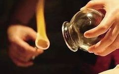 The Marvelous Cupping Therapy in Traditional Chinese Medicine: Many Benefits, but Not for Everyone!