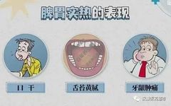 Combined Medication for Spleen and Stomach Damp-Heat Syndrome