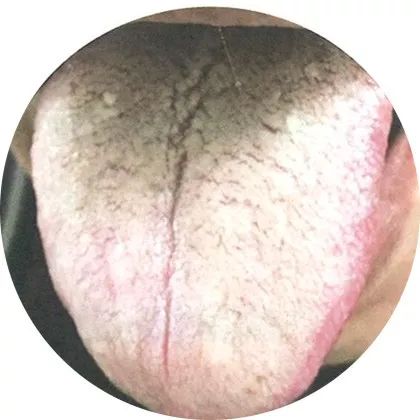 The Most Comprehensive High-Definition Real Tongue Diagnosis: Observing Tongue Patterns to Understand Internal Organs (Collection Edition)