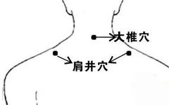 Conditions That Can Be Alleviated by Gua Sha