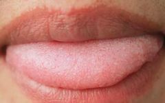 Comprehensive Tongue Diagnosis Guide