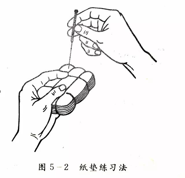 Needles and Daily Acupuncture Practice Techniques
