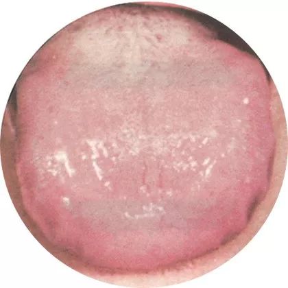 The Most Comprehensive High-Definition Real Tongue Diagnosis: Observing Tongue Patterns to Understand Internal Organs (Collection Edition)