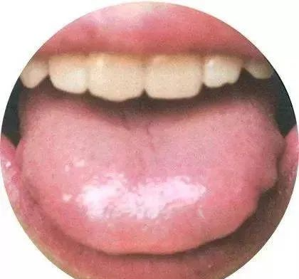 130 High-Definition Tongue Diagnosis Charts (Recommended for Collection)