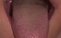 Symptoms Indicating Progression Beyond Simple Exterior Syndrome in Exogenous Diseases