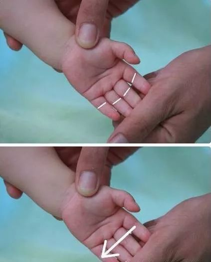 21 Pediatric Tuina Techniques to Easily Address Common Childhood Ailments!
