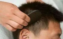 Health Science Popularization | Scraping Away Headaches - Scalp Gua Sha