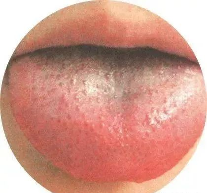 130 High-Definition Tongue Diagnosis Charts (Recommended for Collection)