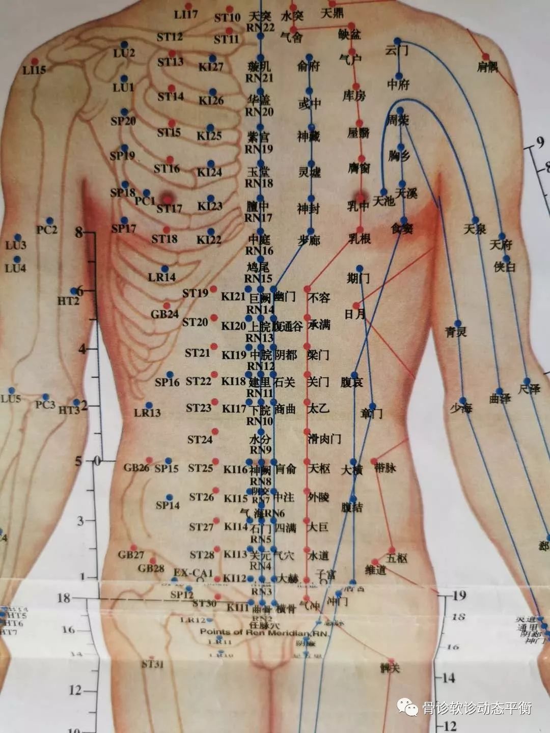 The Scope and Boundaries of the Efficacy of Fine Needling