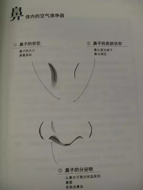 Essence of TCM Observation Diagnosis Illustrated