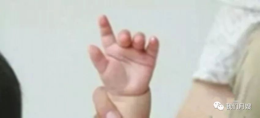 21 Techniques of Pediatric Tuina: Simple and Easy to Learn with Animated Demonstrations