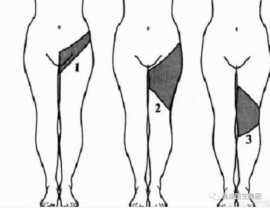 Diagnosis and Inquiry of Low Back Pain