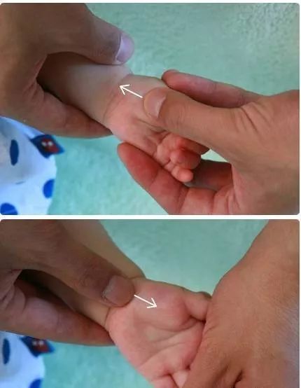 21 Pediatric Tuina Techniques to Easily Address Common Childhood Ailments!