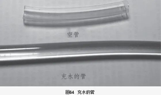Understanding the Xian Pulse in Traditional Chinese Medicine