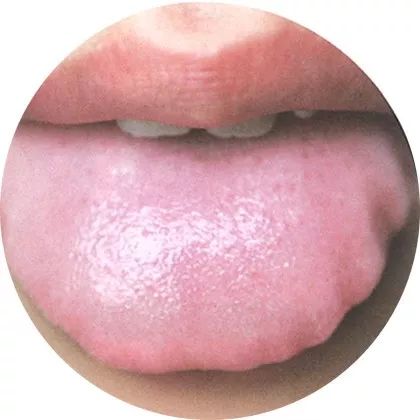 The Most Comprehensive High-Definition Real Tongue Diagnosis: Observing Tongue Patterns to Understand Internal Organs (Collection Edition)