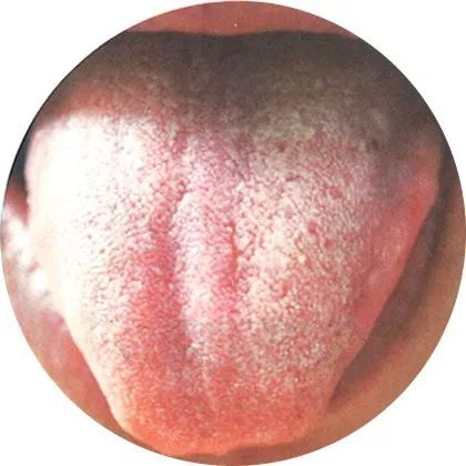 The Most Comprehensive High-Definition Real Tongue Diagnosis: Observing Tongue Patterns to Understand Internal Organs (Collection Edition)