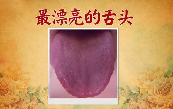 The TCM Tongue Diagnosis Atlas is Here! Observe the Tongue to Understand the Whole Body!
