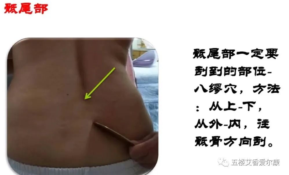 Summary of Common Diseases and Gua Sha Treatment Plans Including Human Reflex Maps, Contraindications, and Diagnosis of Sha Patterns