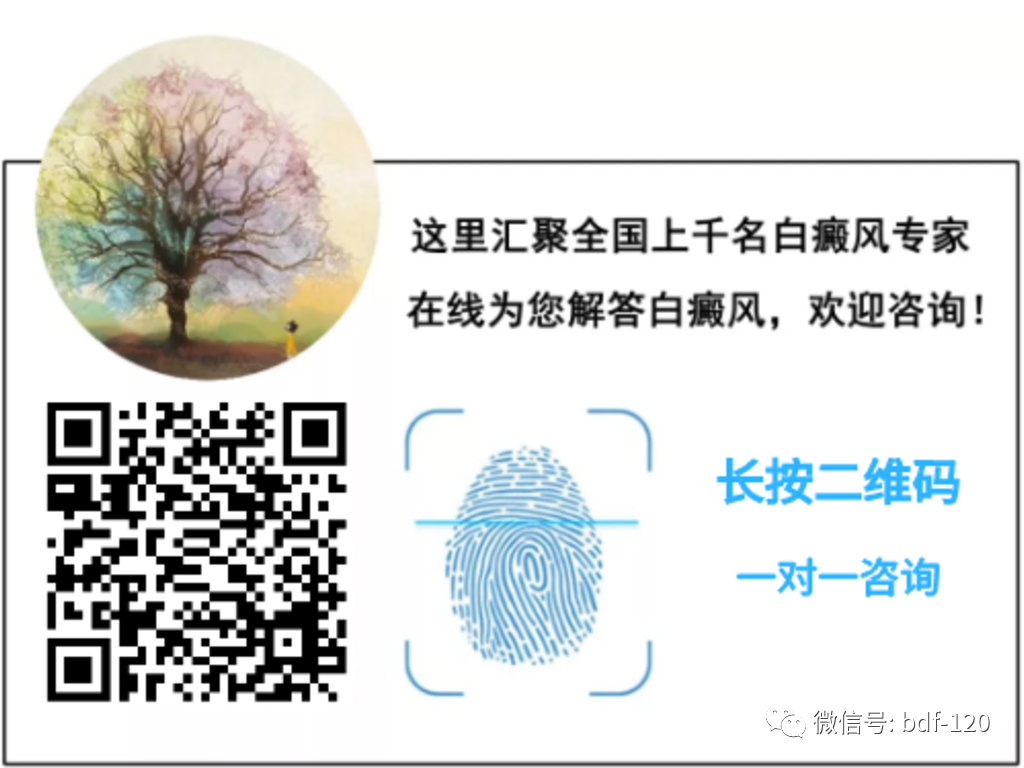 External Treatment Methods of Traditional Chinese Medicine for Vitiligo