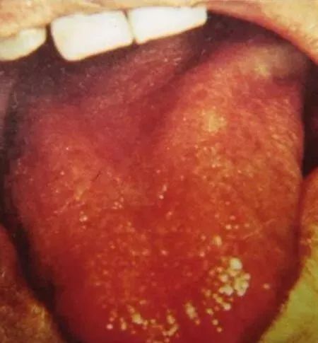Comprehensive Guide to Tongue Diagnosis and Associated Conditions in TCM