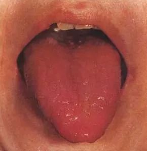 The Health Code Hidden on Your Tongue