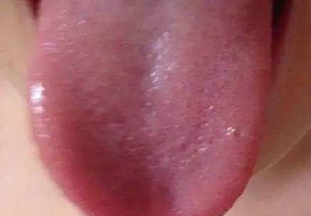 Four Tongue Coating Colors Revealing Your Body Condition