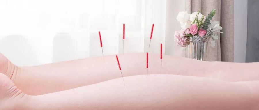 Five Essential Steps for Beginners in Acupuncture