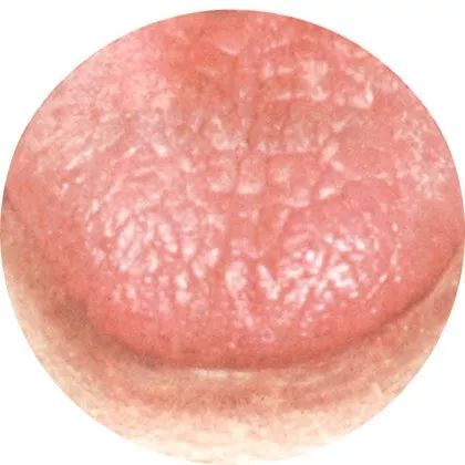 Comprehensive Guide to Tongue Diagnosis: A Must-Collect!