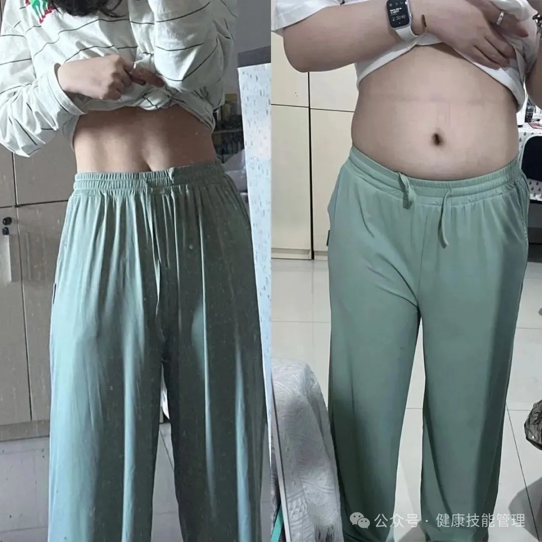 The First Step in Weight Management: Adjusting Phlegm-Damp Constitution