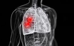 What is Liver Qi Stagnation?